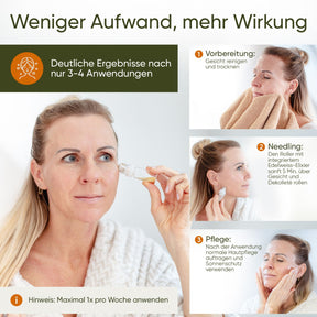 Better Aging Needling Komplettset für Zuhause